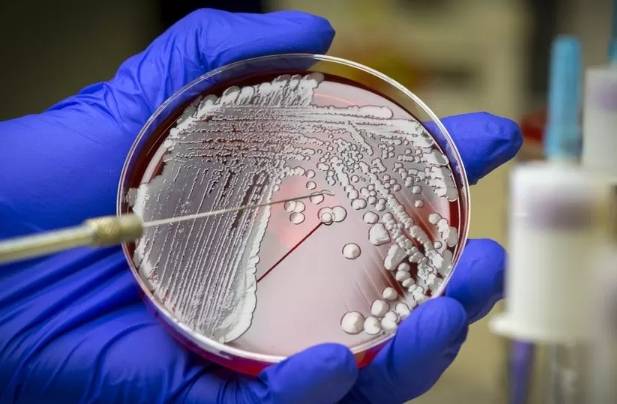 Bacteria being grown in the laboratory